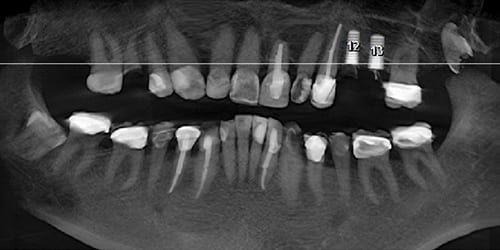 versah-case-slide-3